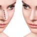 rhinoplastydubai146