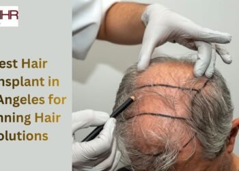 Best Hair Transplant in Los Angeles for Thinning Hair Solutions 1