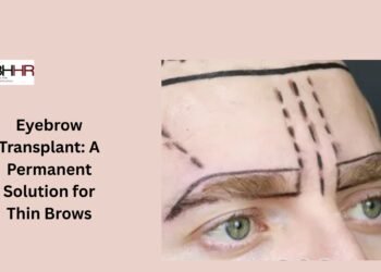 Eyebrow Transplant A Permanent Solution for Thin Brows