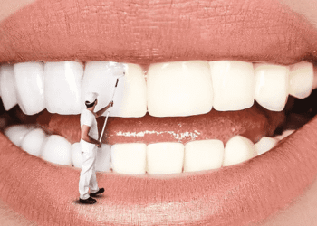 dentmv2 optimized 1