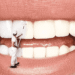 dentmv2 optimized 1