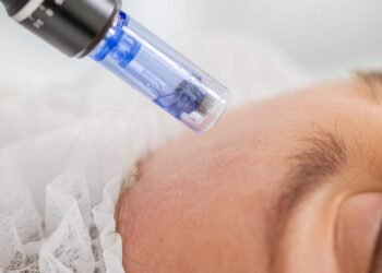 what can microneedling do 1