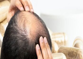 Hair Loss Treatment in Riyadh