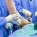 Shoulder Surgery DRHC