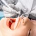 Top 5 Benefits of a Teeth Cleaning 1024x684 1