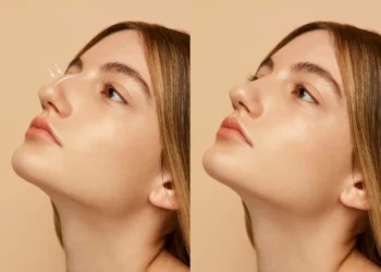 How to Choose the Best Rhinoplasty Surgeon in Dubai What Age Can You Get Rhinoplasty Nose Job In Dubai scaled 1