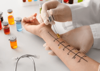 allergy testing in dubai