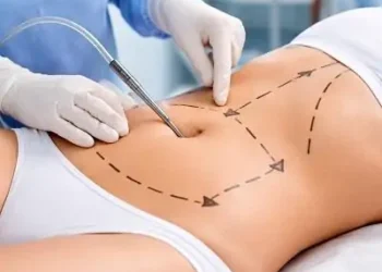 Vibro liposuction in dubai Abu Dhabi