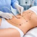 Vibro liposuction in dubai Abu Dhabi