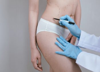 lipo