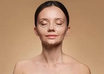 Facelift Rhytidectomy Surgery In Delhi Dr Rajat Gupta RG Aesthetics Cosmetic Plastic Surgeon 640x347.jpg 1