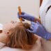 PRP Hair Treatment in Riyadh 18