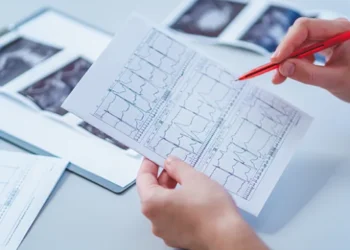 7 Key Things to Know Where to Get EKG Test Near Me? What Can You Expect From The EKG or ECG Test 2