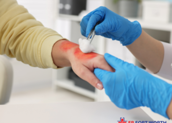 Burn Treatment: 9 Smart Steps for Safer Emergency Care Today burns treatment 1