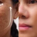 image before and after anti aging dark spot 1024x1024 1